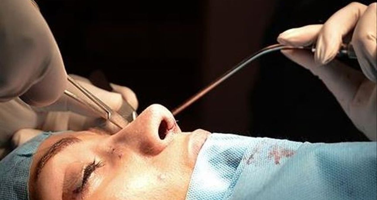 Rinoplasti hem estetik hem nefes sorunlarını düzeltiyor